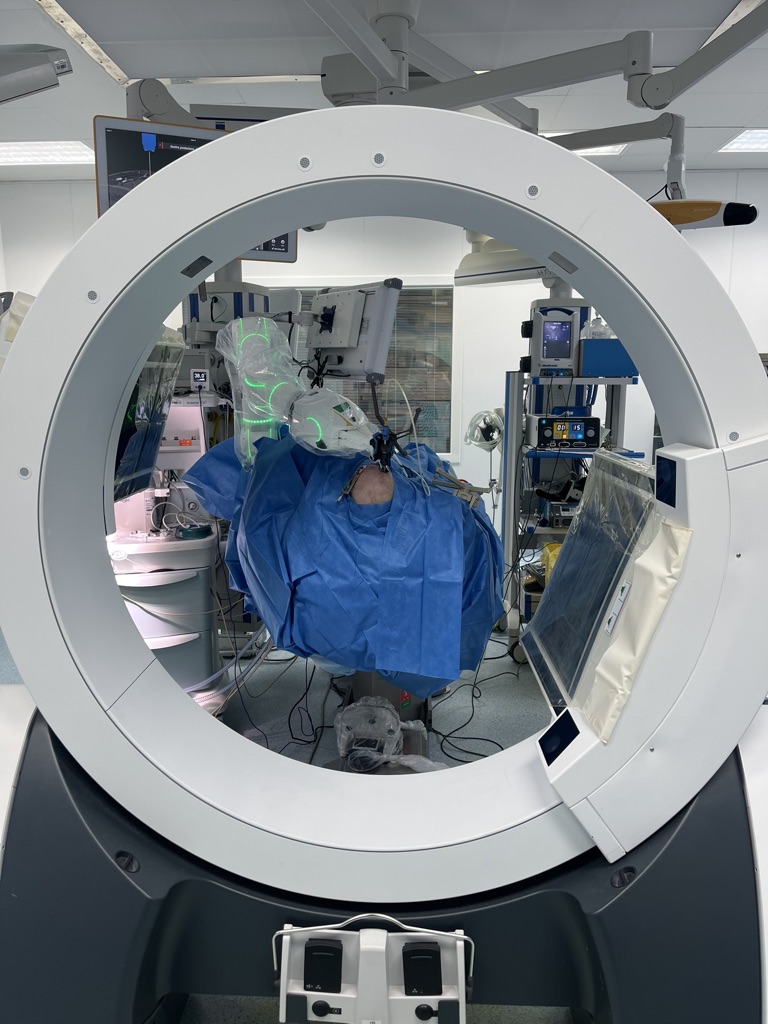 Chirurgia cerebrale guidata da Robot e TC Intraoperatoria