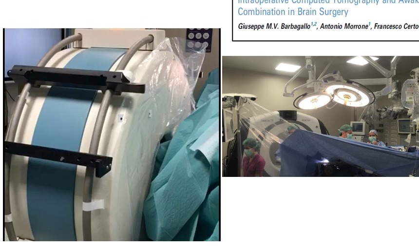 Sala operatoria con TC intraoperatoria BodyTom durante un intervento di awake surgery